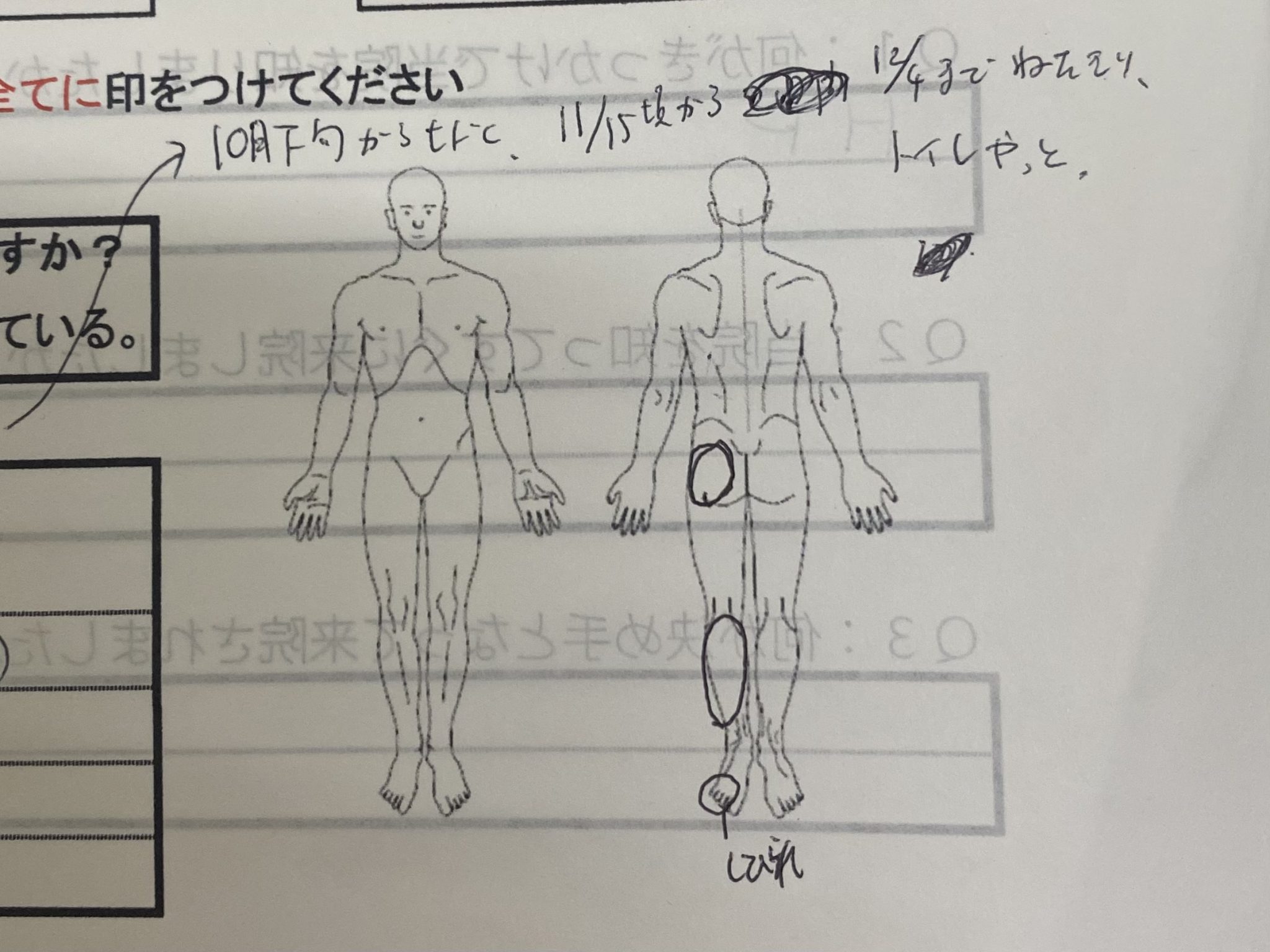 自転車転んで肩痛み 1年治らない