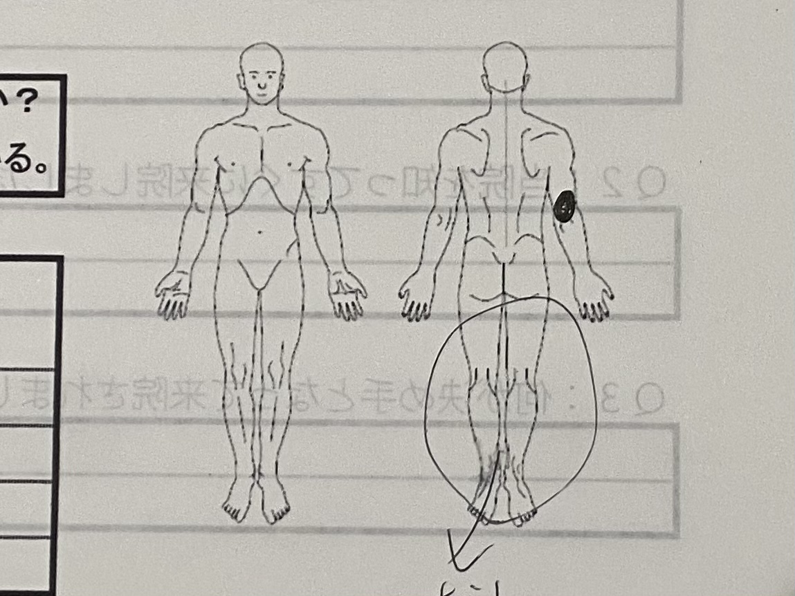 腕の痛み 腰痛専門 通わせない整体院じゅらく 金沢西念院